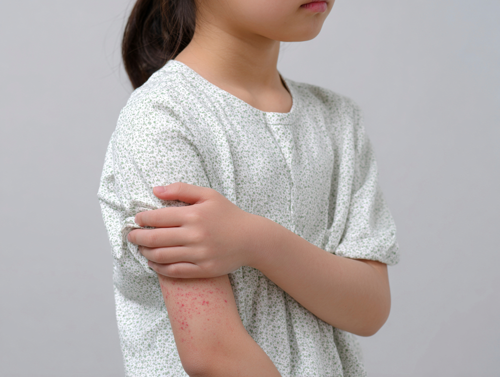 * 아토피 극복 캠프아토피 환아와 보호자가 함께 참여하는 단기 집중 치유캠프를 운영합니다. - 1박 2일 / 2박 3일 / 3박 4일 / 4박 5일 과정 - 환아와 보호자 동반 참여 - 상담 → 교육 → 체험 → 휴식이 연계된 프로그램 구성 - 국립공원관리공단 및 사회단체 연계 운영