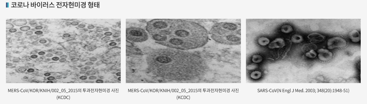 코로나 바이러스 전자현미경 형태